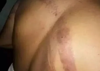 রাজীব করের শরীরে আঘাতের চিহ্ন