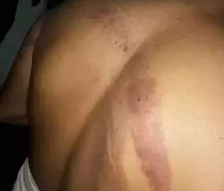 রাজীব করের শরীরে আঘাতের চিহ্ন