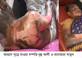 সাঁথিয়ায় এক দম্পতিকে পুড়িয়ে হত্যাচেষ্টা